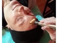 Vorschaubild Video: Mesoporation Schritt zwei