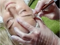 Vorschaubild Video: Mikrodermabrasion im Kosmetikstudio Nikola